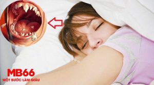 Luận giải điềm báo mơ thấy rụng răng